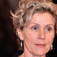 Illustration for article titled Frances McDormand Hates Plastic Surgery and Wants Actors to Quit It